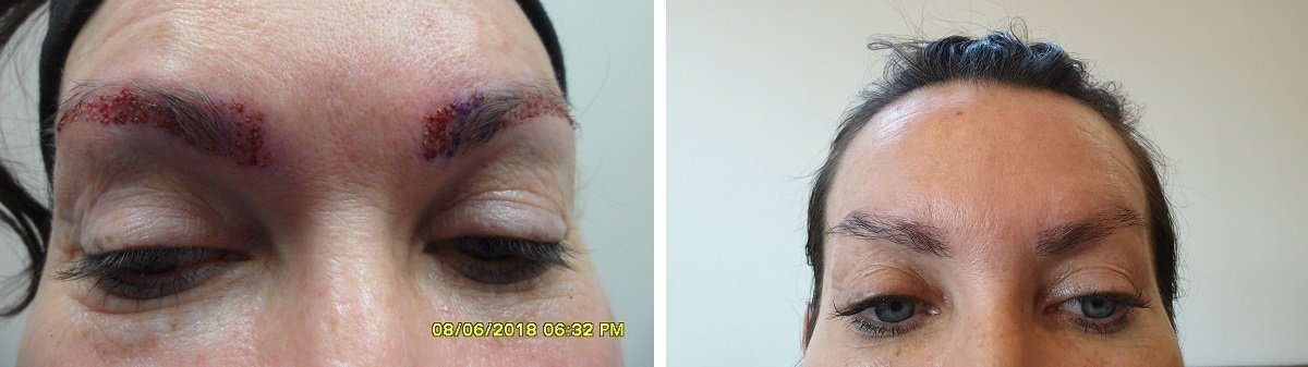 Eyebrows