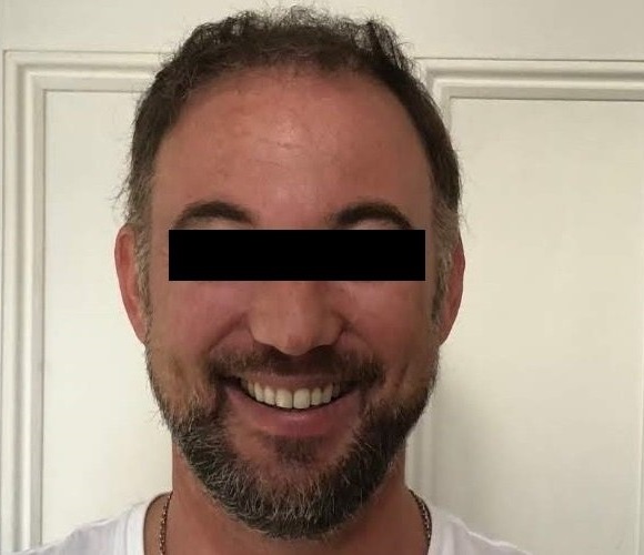 head-3.jpg